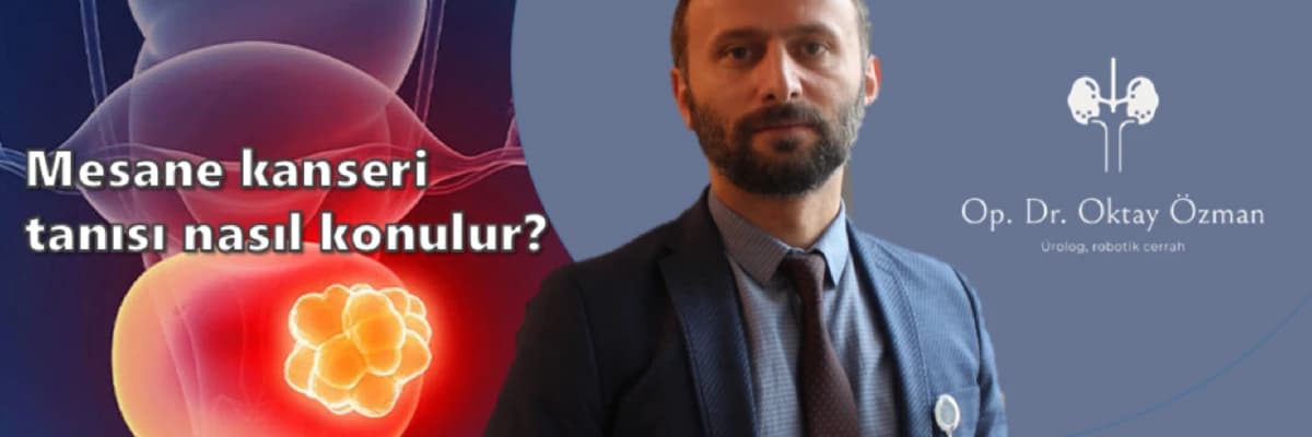 Mesane kanseri tanısı nasıl konulur?