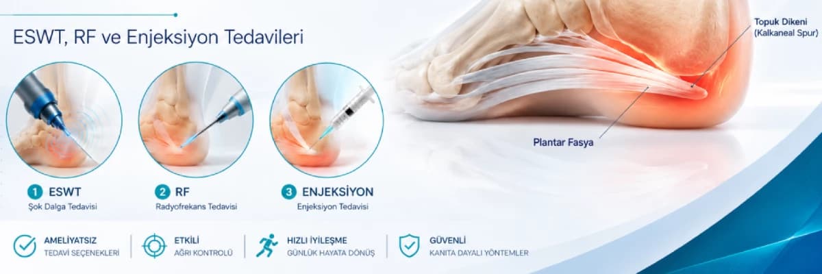 Topuk Dikeni Nedir? ESWT, Radyofrekans ve Enjeksiyon Tedavileri