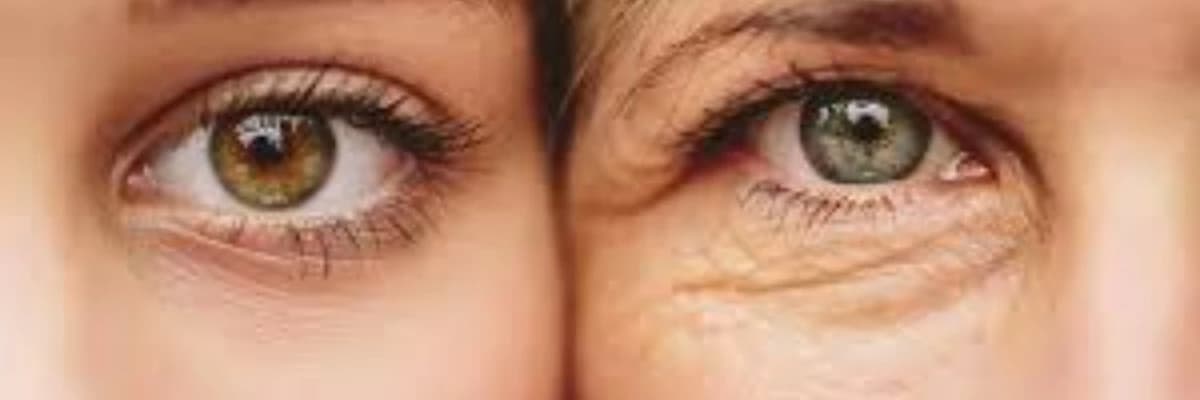 Yüz yenileme programları (germe- yenileme- dolgu- botoks işlemleri)