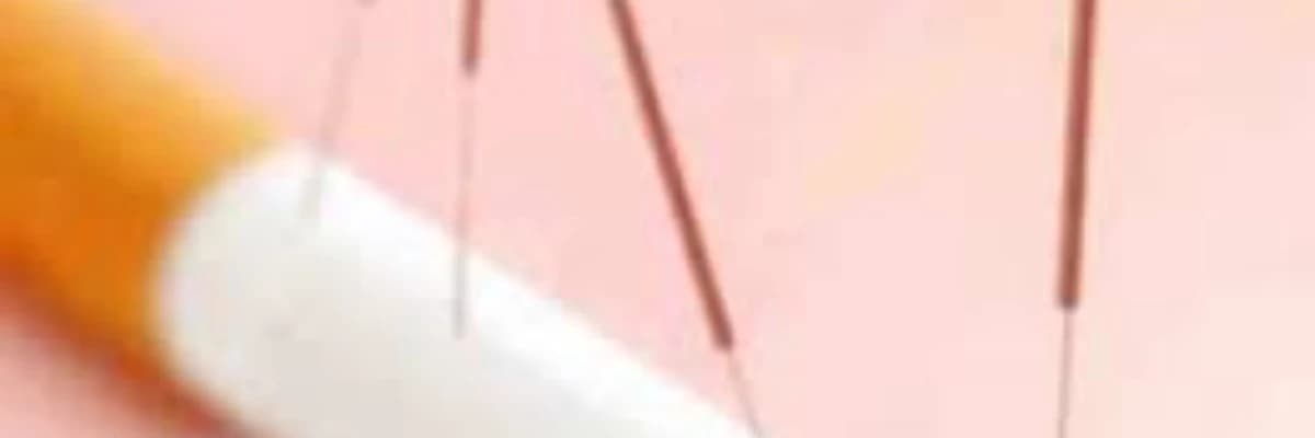 Sigarayı Bırakmaya Akupunturun Etkisi