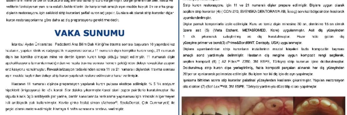 TRAVMATİK GENÇ SÜREKLİ DİŞLERDE MODİFİYE REVASKÜLARİZASYON TEDAVİSİ VE STRİP KURON