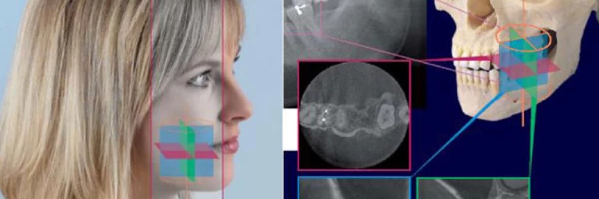 Dental Tomografi Nedir?