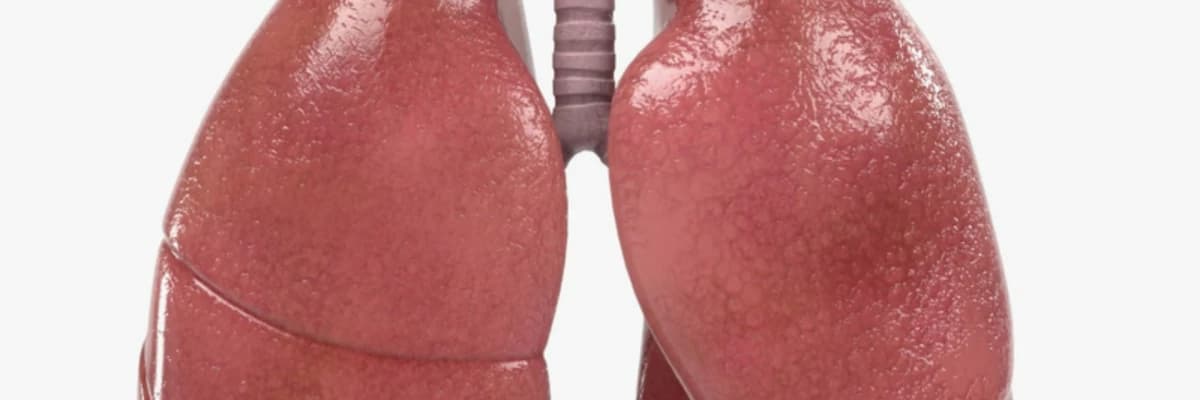 Kadınlarda akciğer Kanseri