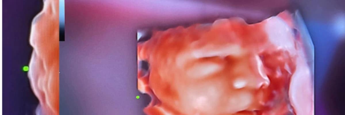 4 Boyutlu Ayrıntılı Ultrason