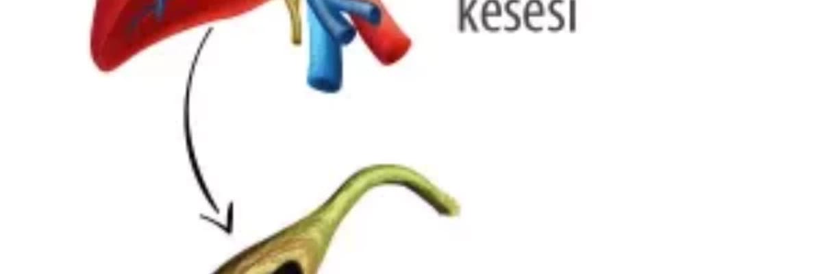 SAFRA KESESİ TAŞININ TEDAVİ YÖNTEMİ CERRAHİDİR!