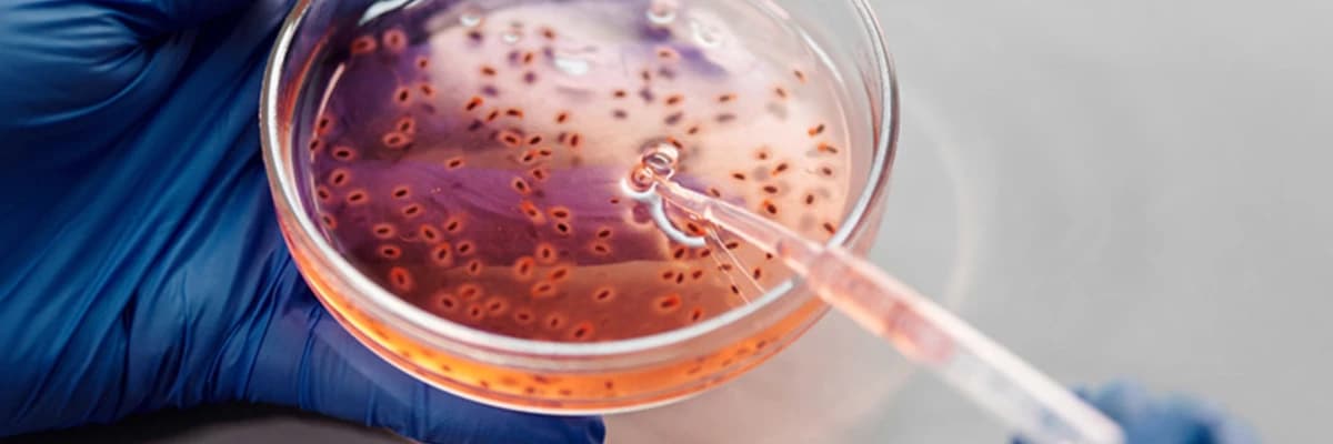 Oksidatif Stres Nedir ?