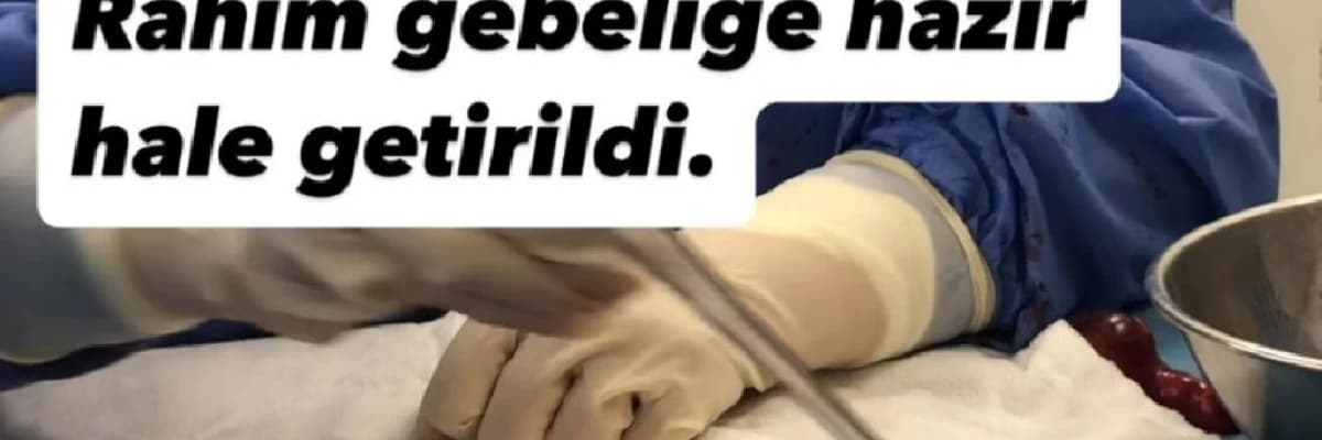 GENÇ VE ÇOCUK SAHİBİ OLMAK İSTEYEN HASTALARDA RAHİM KORUYUCU MİYOM AMELİYATI