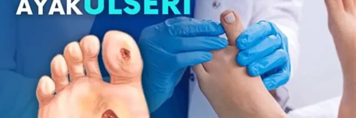 Diyabetik Ayak Bakımı Neden Önemlidir?