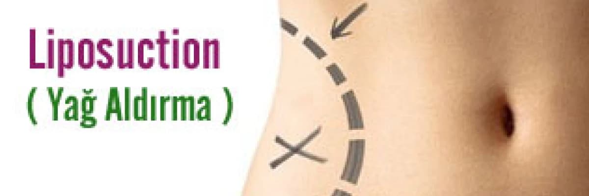 Liposuction ( Yağ Aldırma )