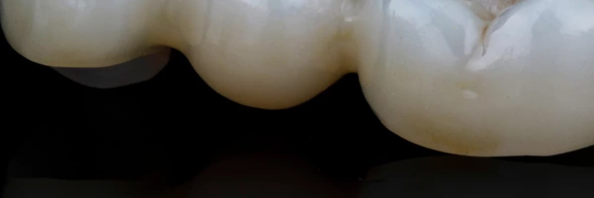 Zirkonyum Nedir? Ne Değildir?