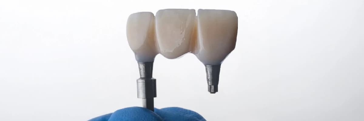 İmplant Yapılırken Ağrı Hissedilir mi? İmplant Tedavisi Ağrılı Bir İşlem midir?