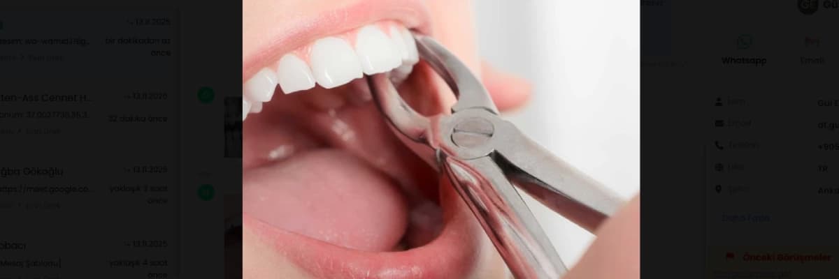 Çekim sonrası dikkat edilecekler