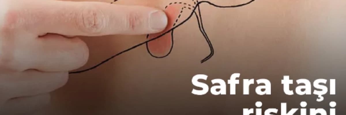 Safra Taşını Riskini Ne Arttırır?