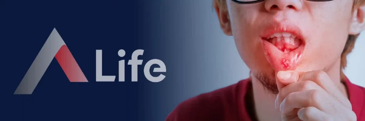 Aftöz Ülser Neden Oluşur?