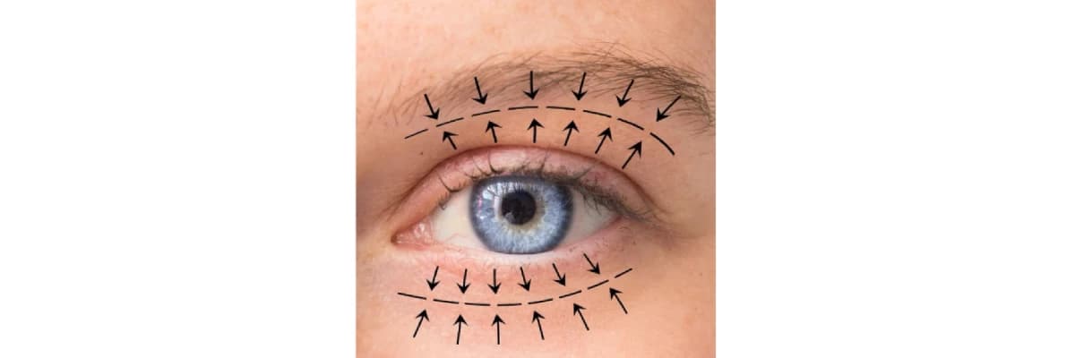 Göz Kapağı Estetiği (Blefaroplasti)