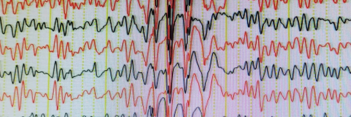 Eeg Neden Önemlidir?