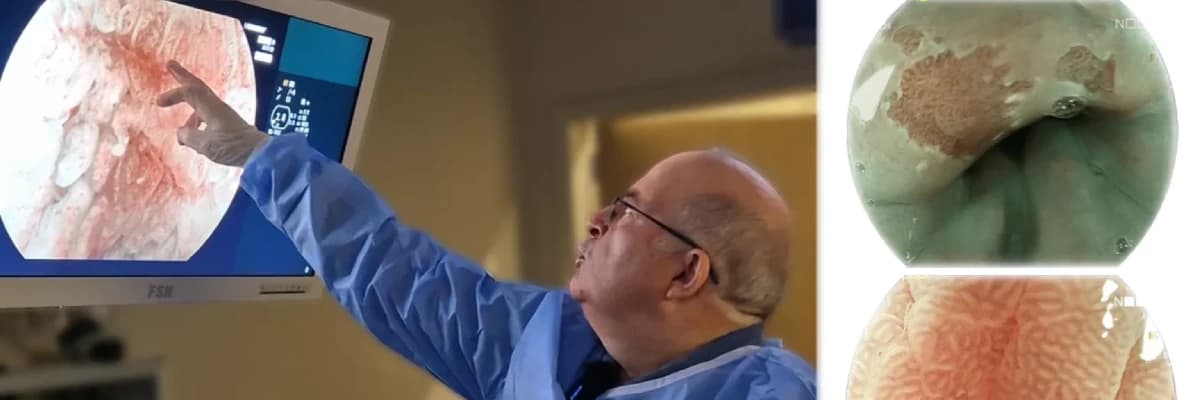 İleri Düzey Endoskopi Ne Zaman Tercih Edilir?