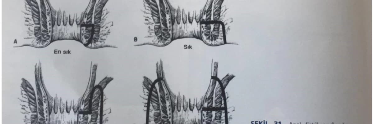 ANAL FİSTÜLLER