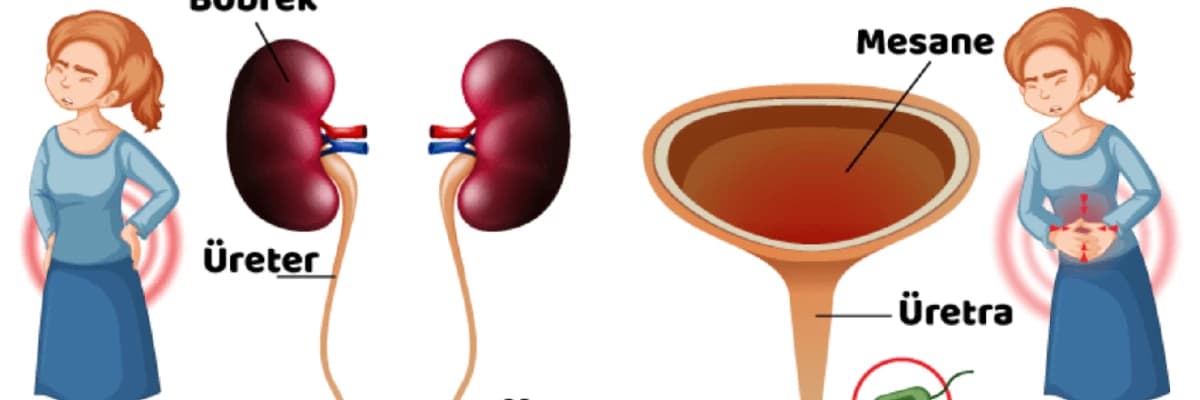 İDRAR YOLU İLTİHABI