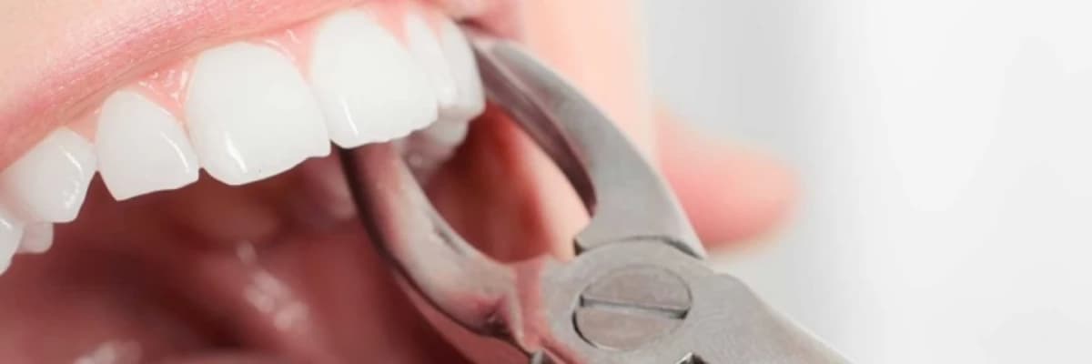 Kanal Tedavi Sonrası Dikkat Edilmesi Gerekenler