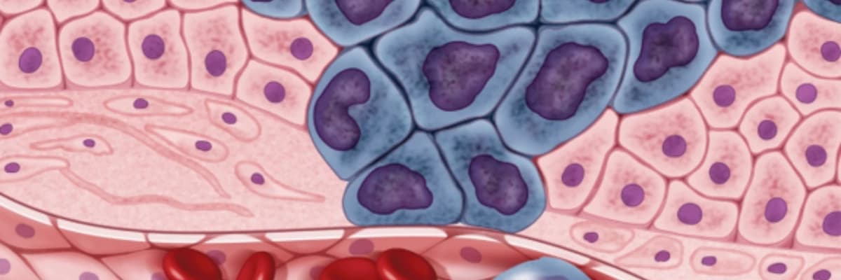 Tekrarlayan Kanserler