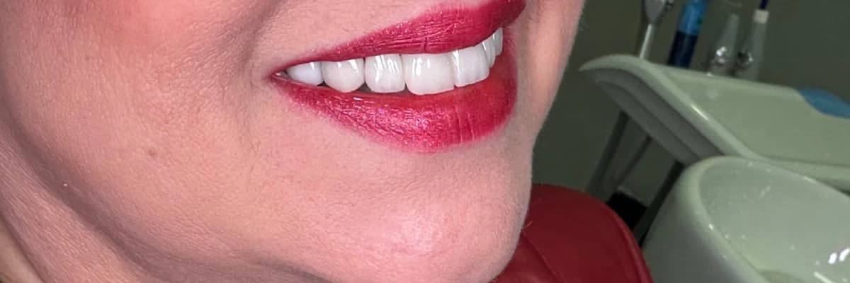 Gülüş tasarımında diş renk ve formunun değerlendirilmesi