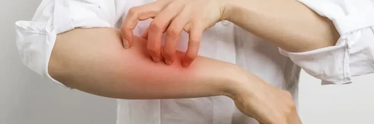 Kliniklerdeki uyuz vakaları yüzde 25’e yükseldi