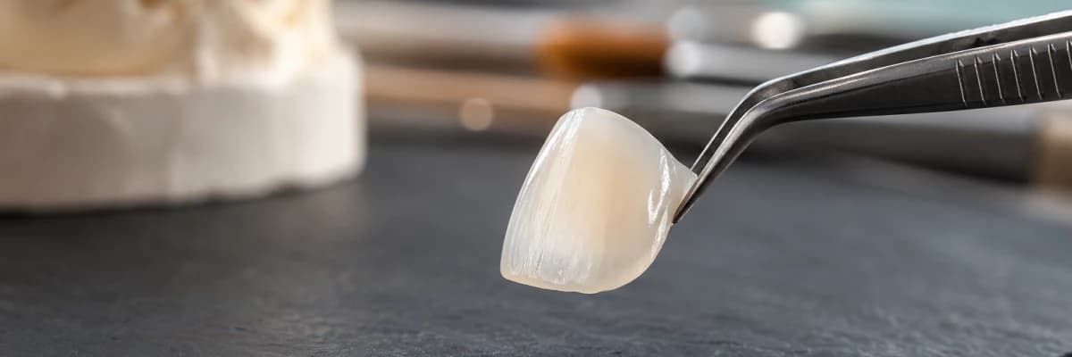Porselen Lamina Nedir? Yaprak Porselen, Diş Kesimi ve Doğal Gülüş Tasarımı
