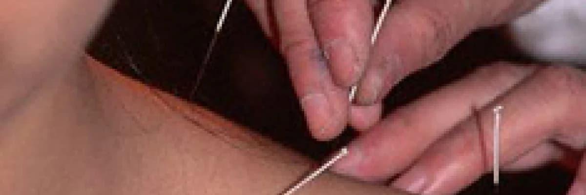AKUPUNKTUR İLE ALLERJİK NEZLE (RİNİT) VE ASTIM TEDAVİSİ