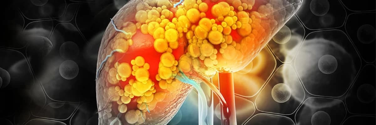 Karaciğer yağlanması