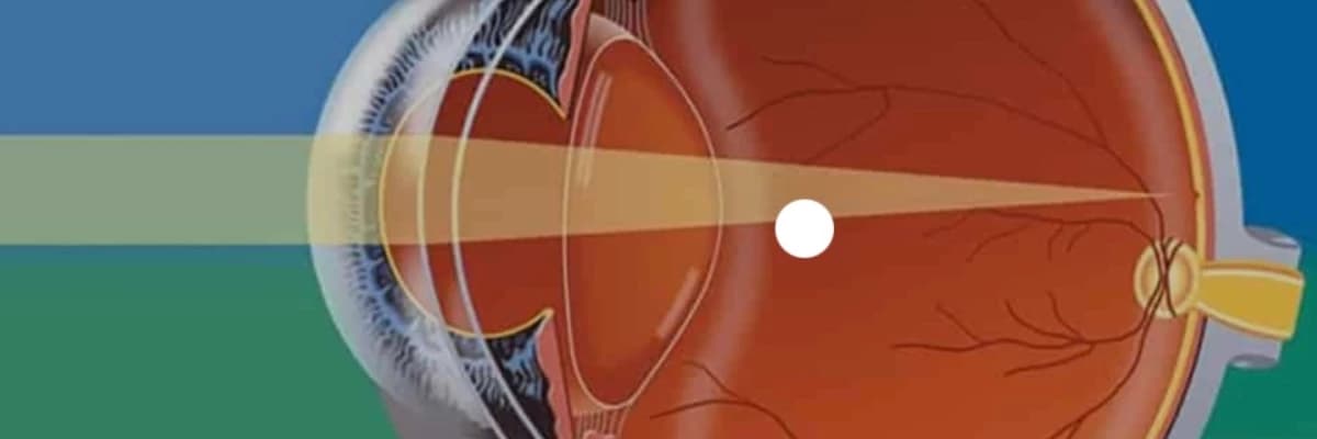 Retina Neresidir?