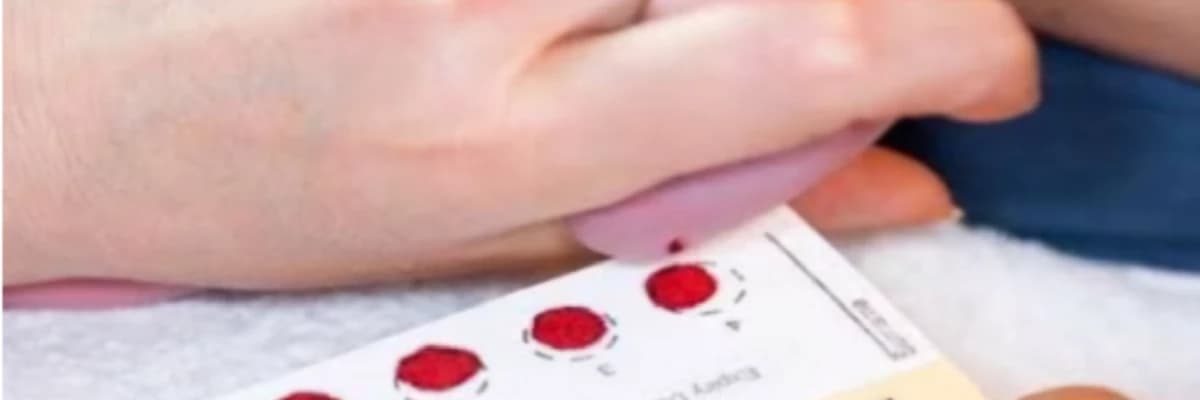 Yenidoğan Bebeklerde Topuk Kanı Neden Alınır?