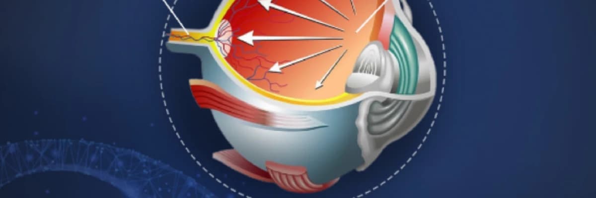 Glokom Hastalığı (Göz Tansiyonu)