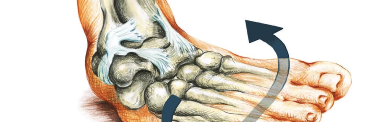 Ayak bileği burkulması nedir?