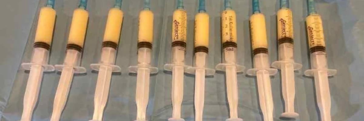 PRP Biofiller ile Erkek Genital Estetiği