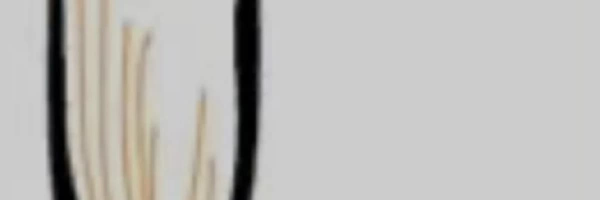 Erkeklerde İdrar Yolu (Üretra) Darlığı