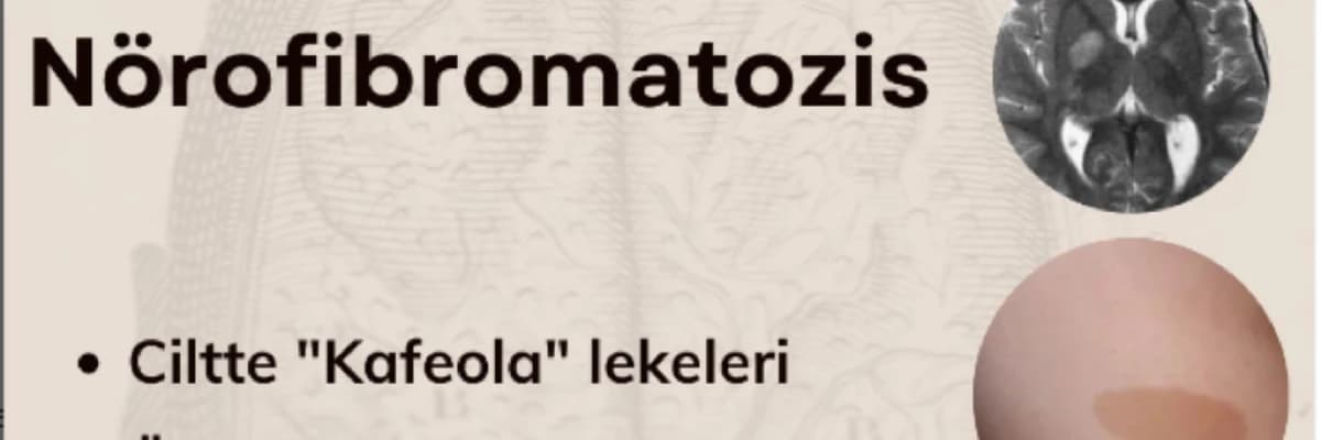 Nörofibromatozis