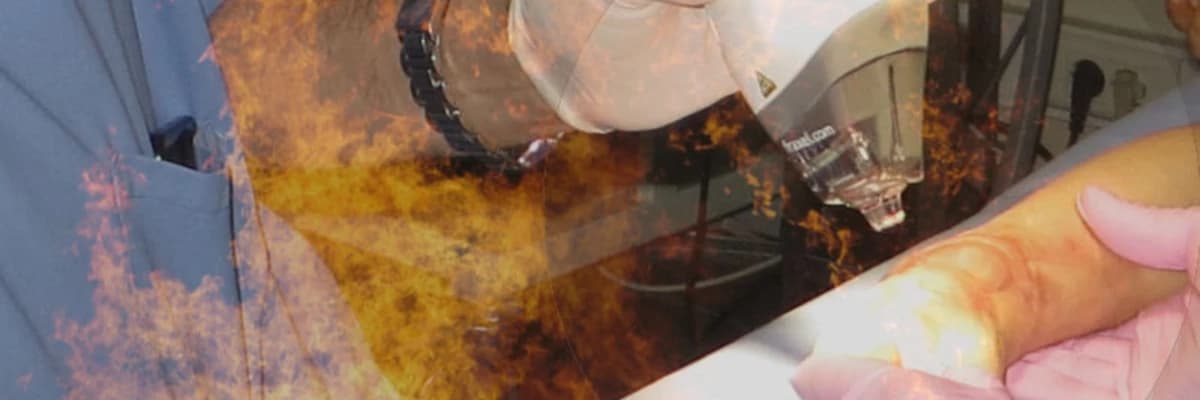 Yanık İzlerinin Modern Tedavisi