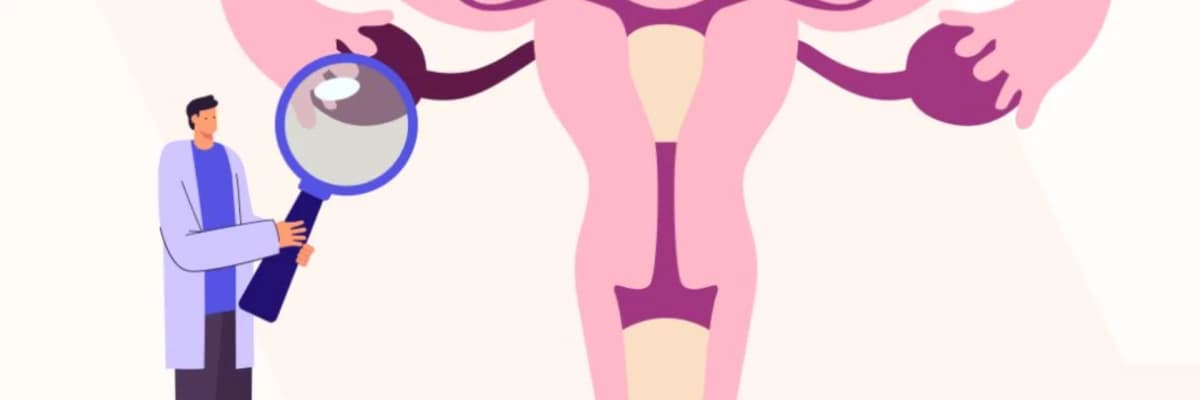 Polikistik Over Sendromu: Belirtiler, Nedenleri