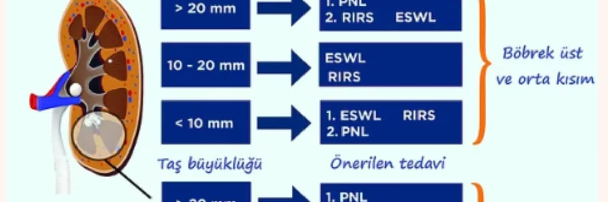 İDRAR YOLU TAŞ HASTALIĞI TEDAVİSİ