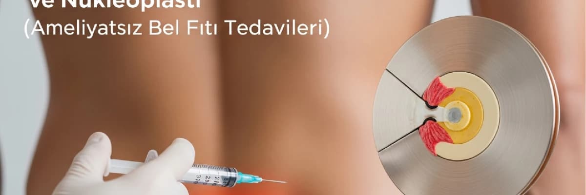 Faset Eklem Enjeksiyonları ve Nükleoplasti (Ameliyatsız Bel Fıtığı Tedavileri)