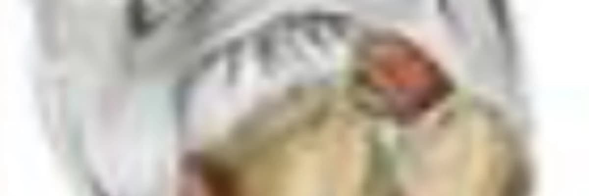 Lateral Collateral Ligament and Biceps Femoris Tendon Fixation with a Suture Anchor to the Tibial Metaphysis after Proximal Fibula En Bloc Resections Preserve Lateral Knee Stability