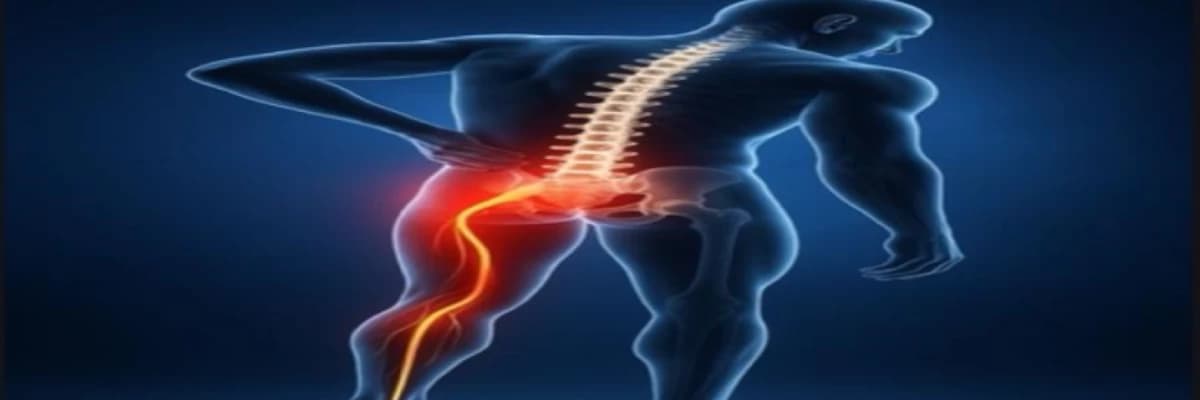 Siyatik Ağrı Nedir? Bel Fıtığı ile Neden Karıştırılır? Ne Zaman Fizyoterapiste Gitmelisiniz?