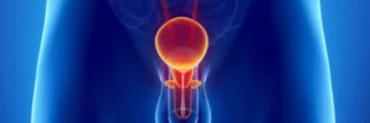 Mesane Kanseri Nedir?