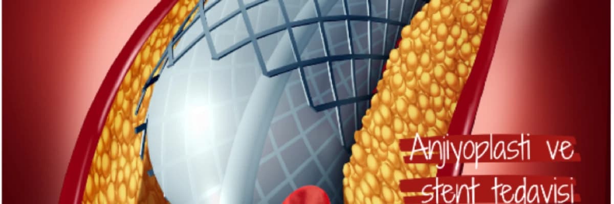 Periferik arter hastalığı tedavileri