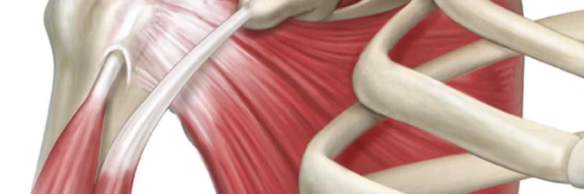 Omuzda Kas Yırtığı (Rotator Cuff Yırtığı) Hakkında Bilmeniz Gereken Her Şey