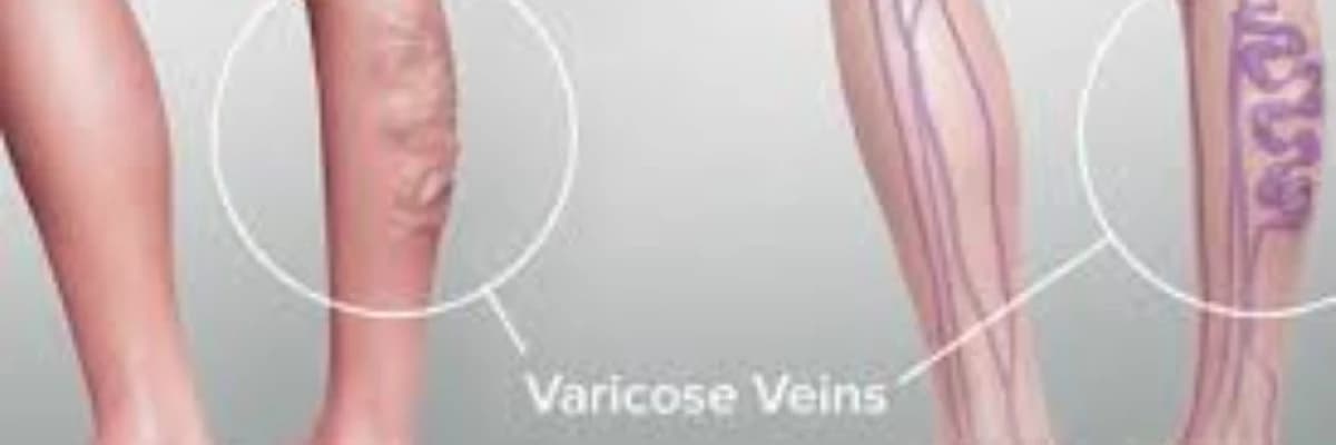 Varisin Yaptığımız İşle Ya Da Meslekle İlgisi Var Mıdır?