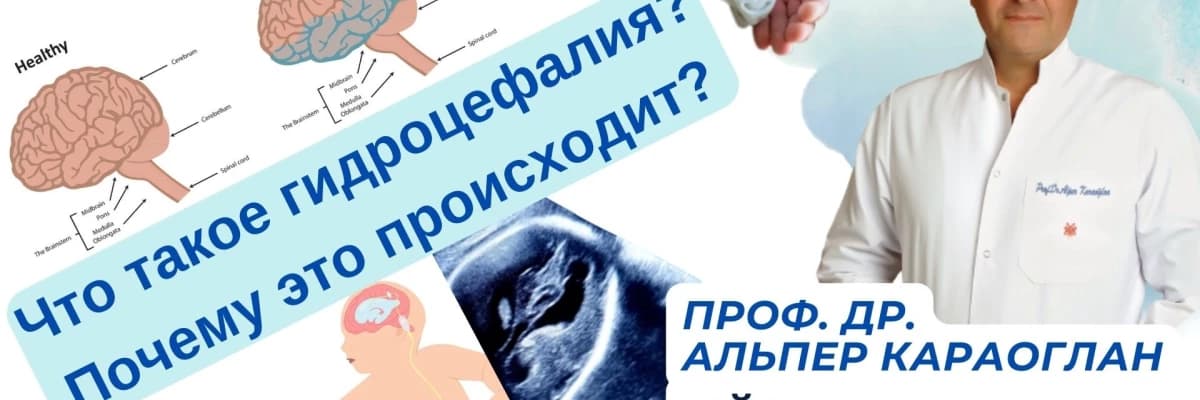 Что такое гидроцефалия? Почему это происходит?