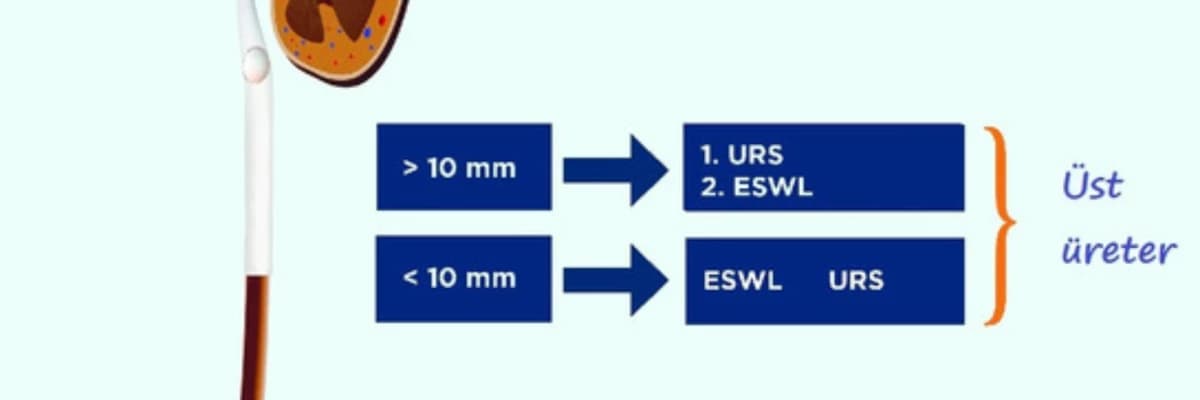 ÜRETER TAŞI TEDAVİSİ