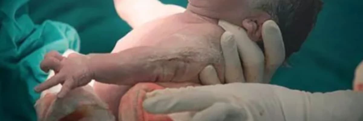 Doğum ve Sezaryen